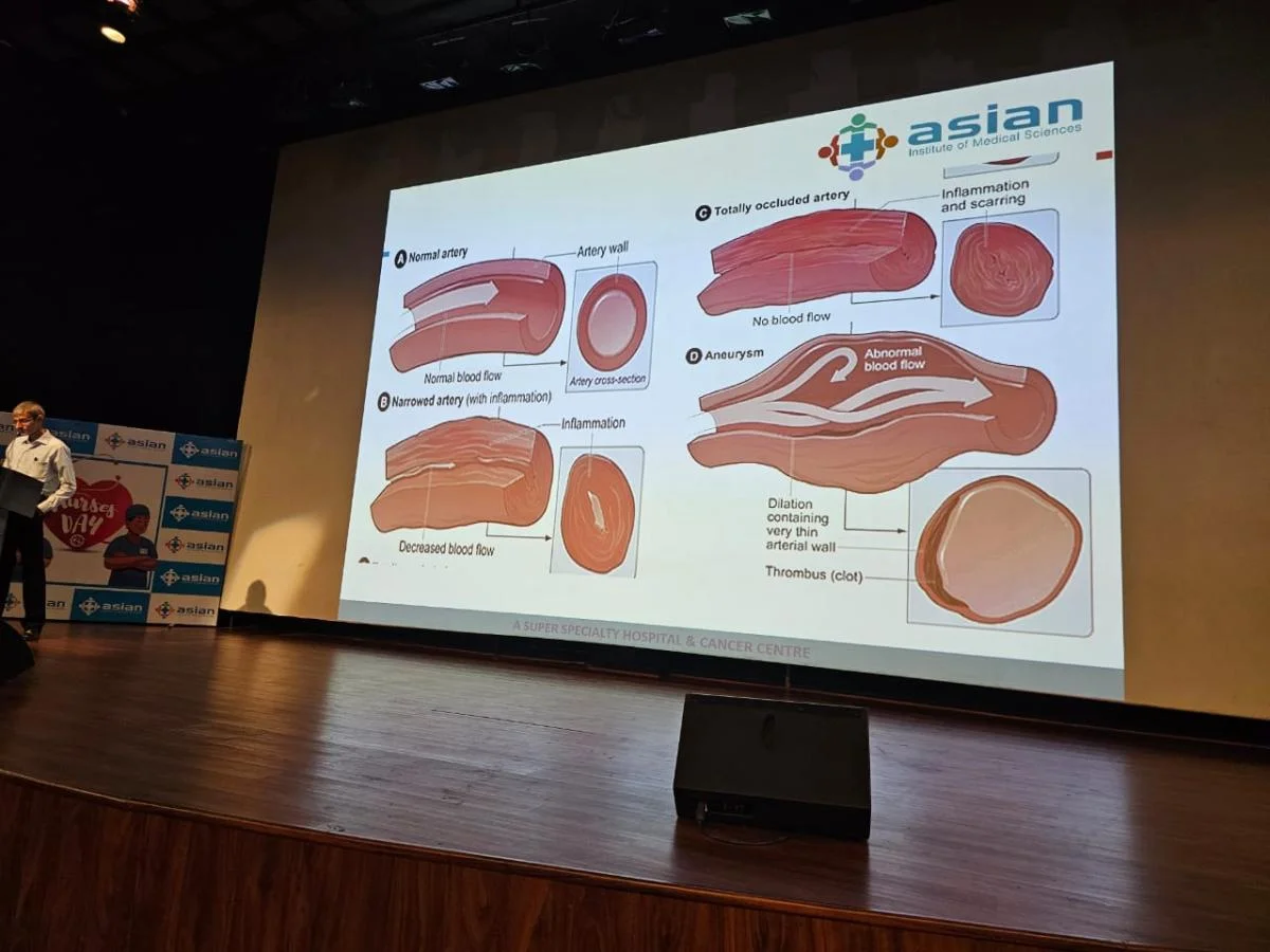 Understanding Vasculitis event — artery diagram presentation