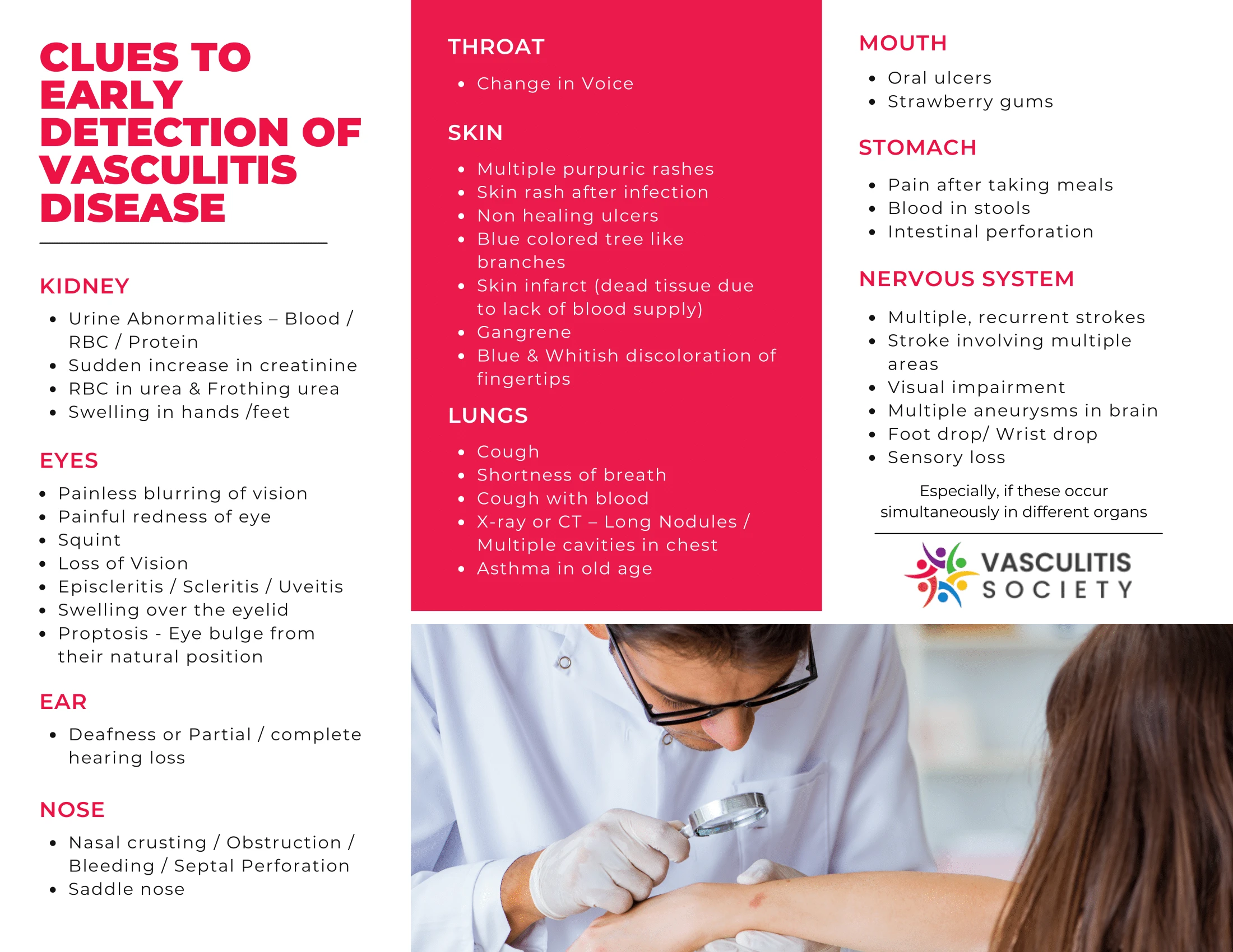 Vasculitis Society Flyer – English Page 2