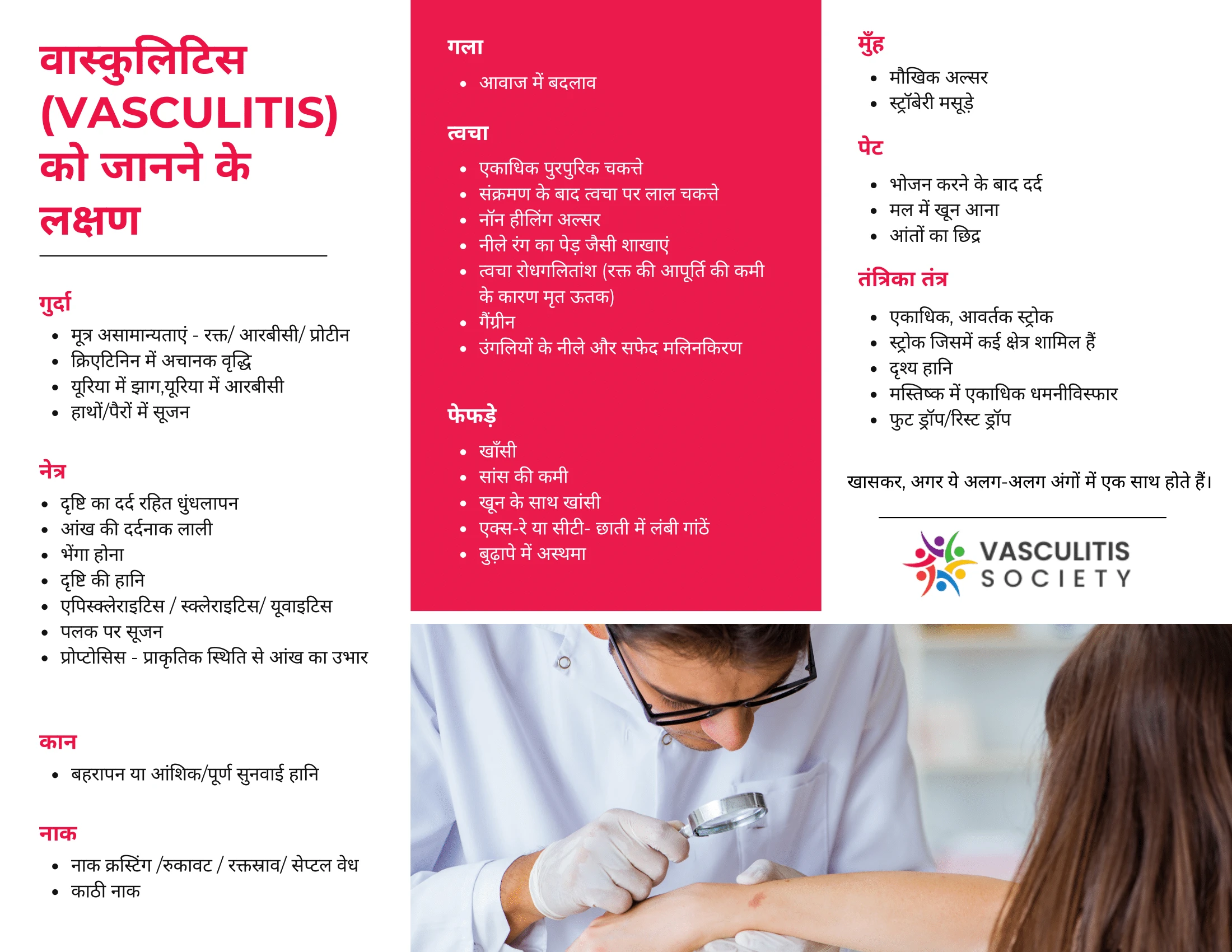 Vasculitis Society Flyer – Hindi Page 2